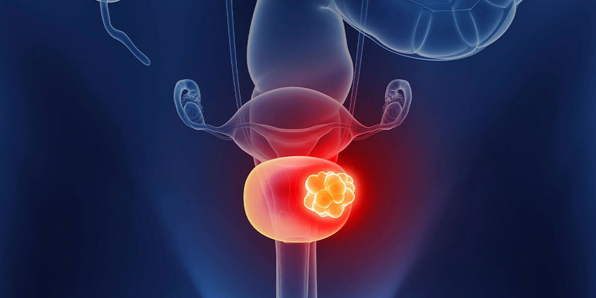 Advanced urological surgery operating theater