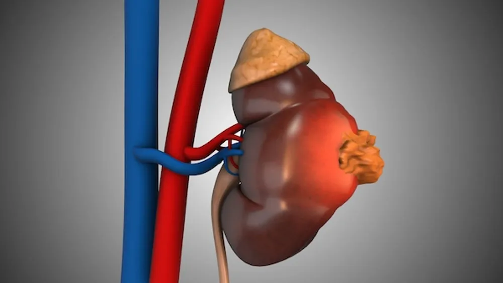 Medical professional reviewing kidney anatomy and scans