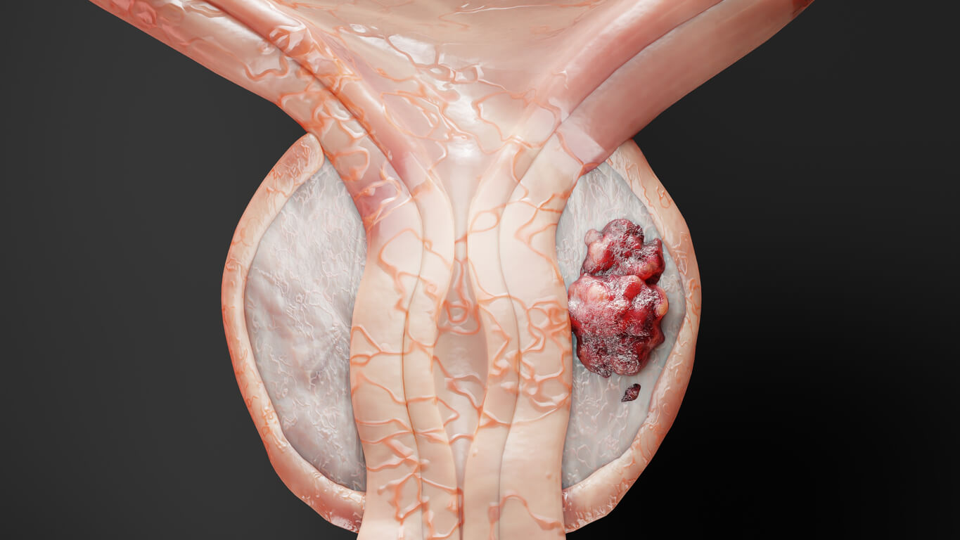 Advanced diagnostic imaging and screening for prostate health