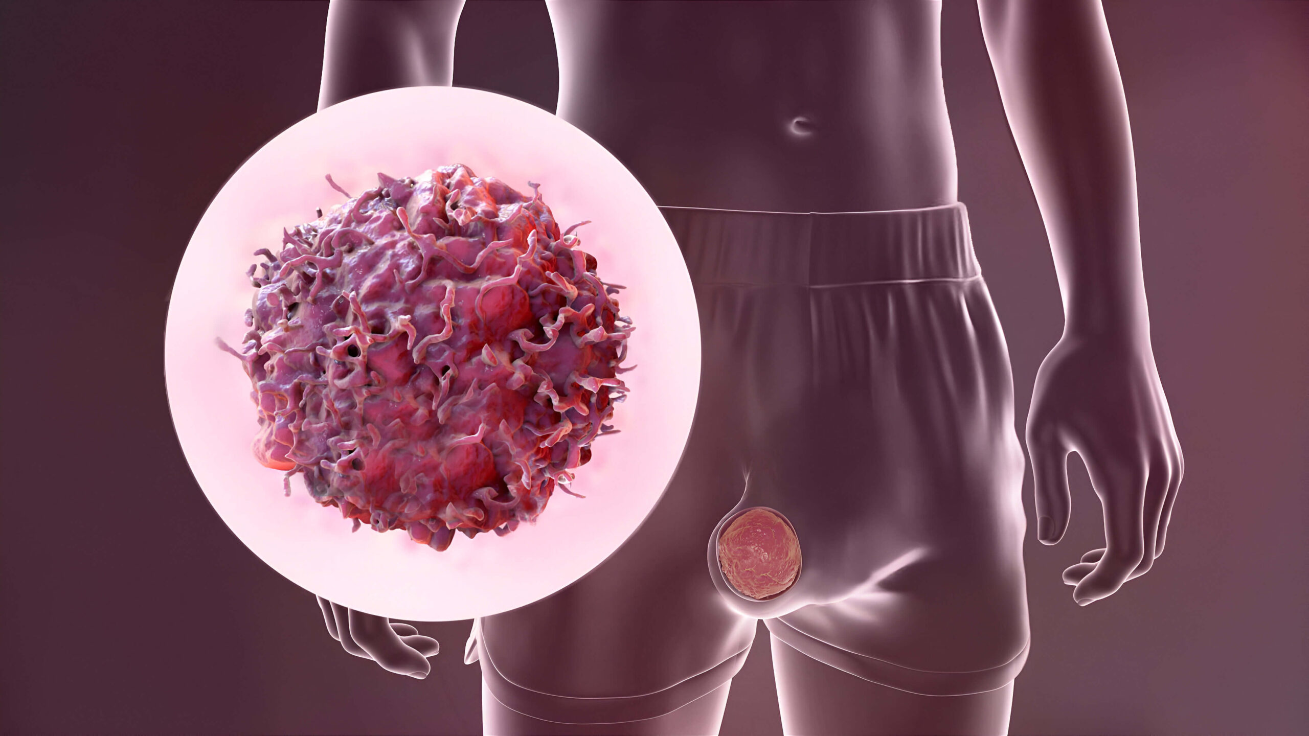 Advanced diagnostic review for urological oncology