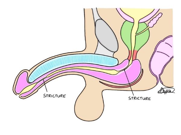 Urologist studying diagnostic imagery for reconstructive surgery
