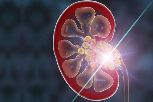 Advanced Laser Technology in a modern operating theater